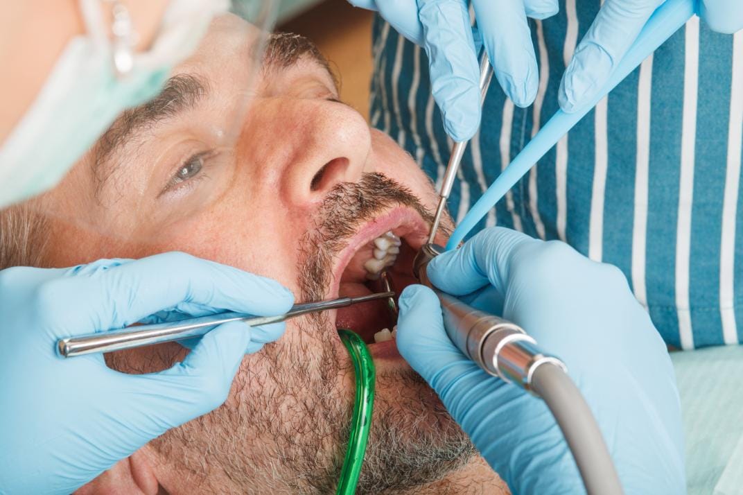 Can I Drive After A Root Canal?