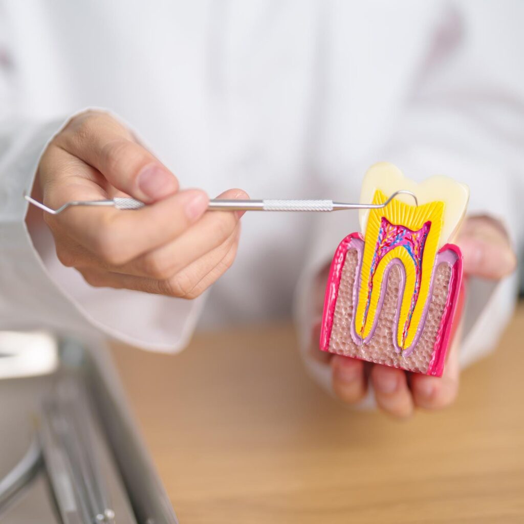 Do Root Canals Cause Cancer