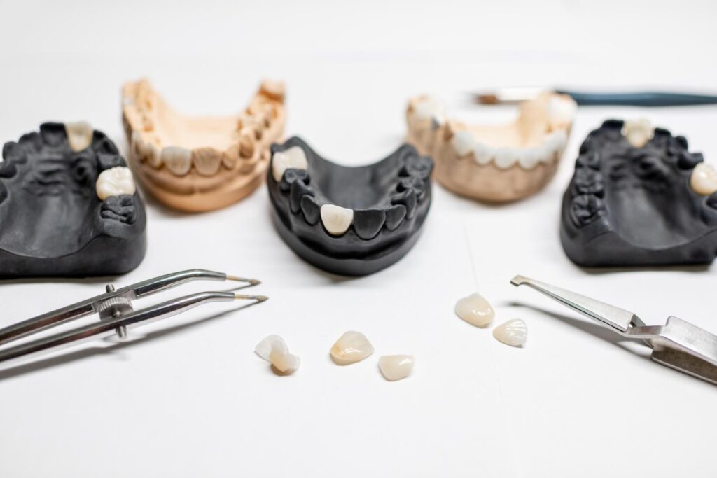 How Much Do Snap-In Denture Implants Cost