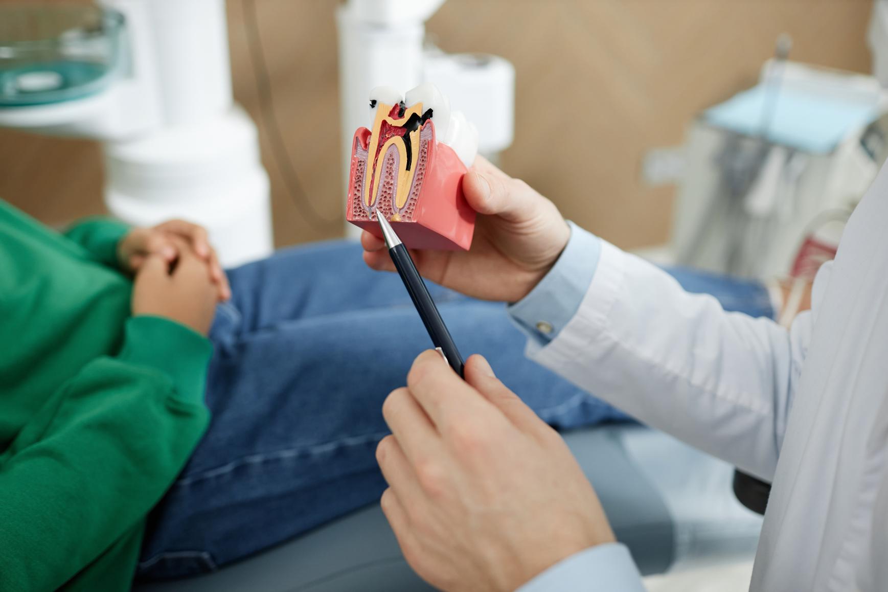 How to Stop Throbbing Pain after Root Canal?