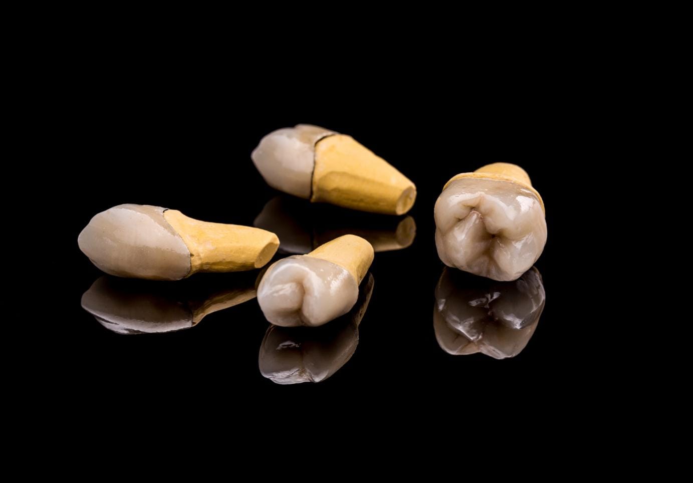 Dental Bone Graft Healing Stages
