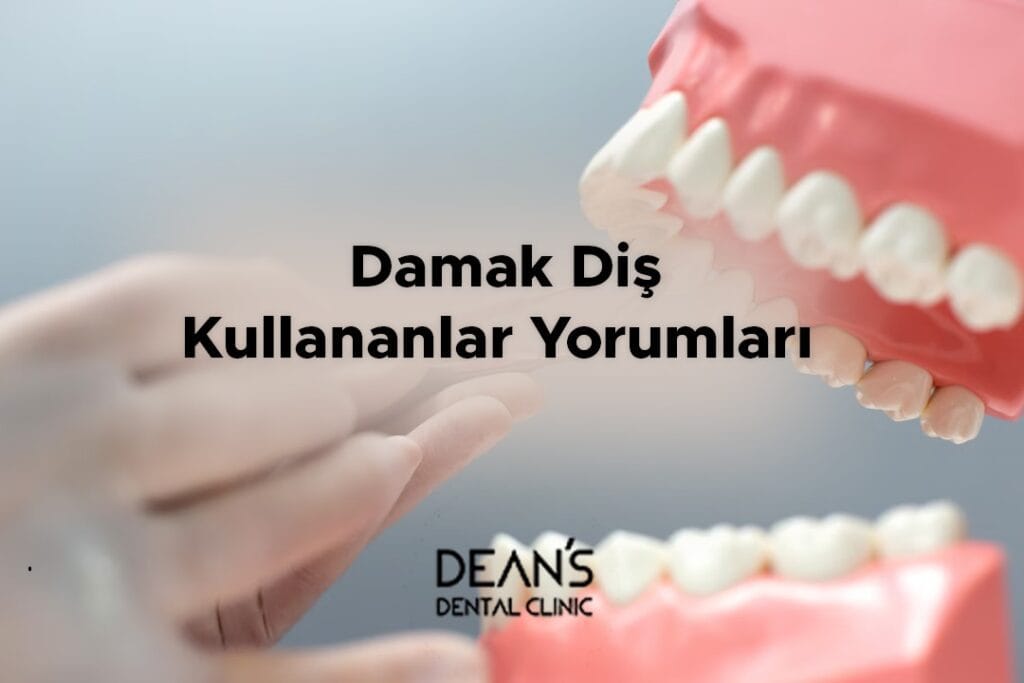 Damak Diş Kullananlar Yorumları