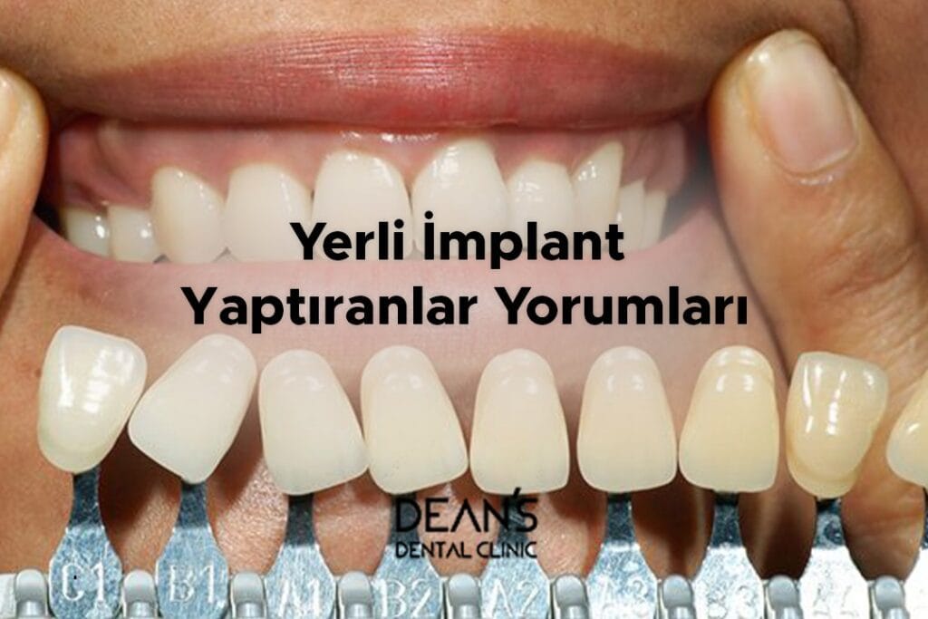 Yerli İmplant Yaptıranlar Yorumları