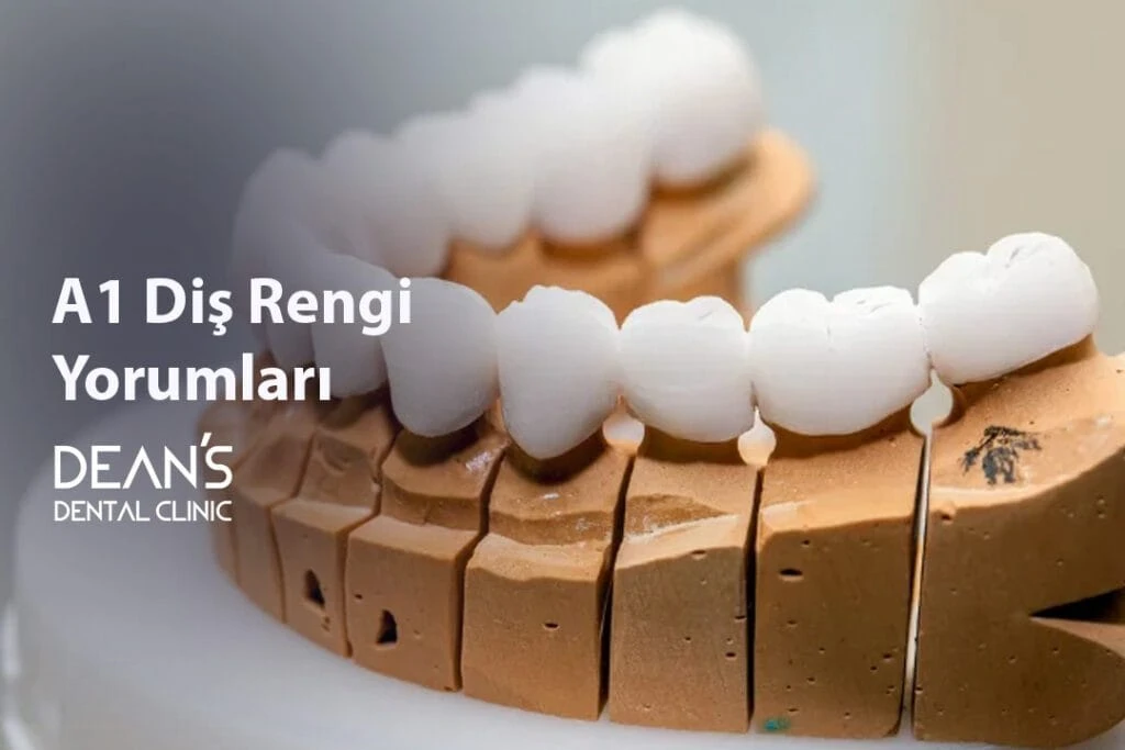 A1 Diş Rengi Yorumları