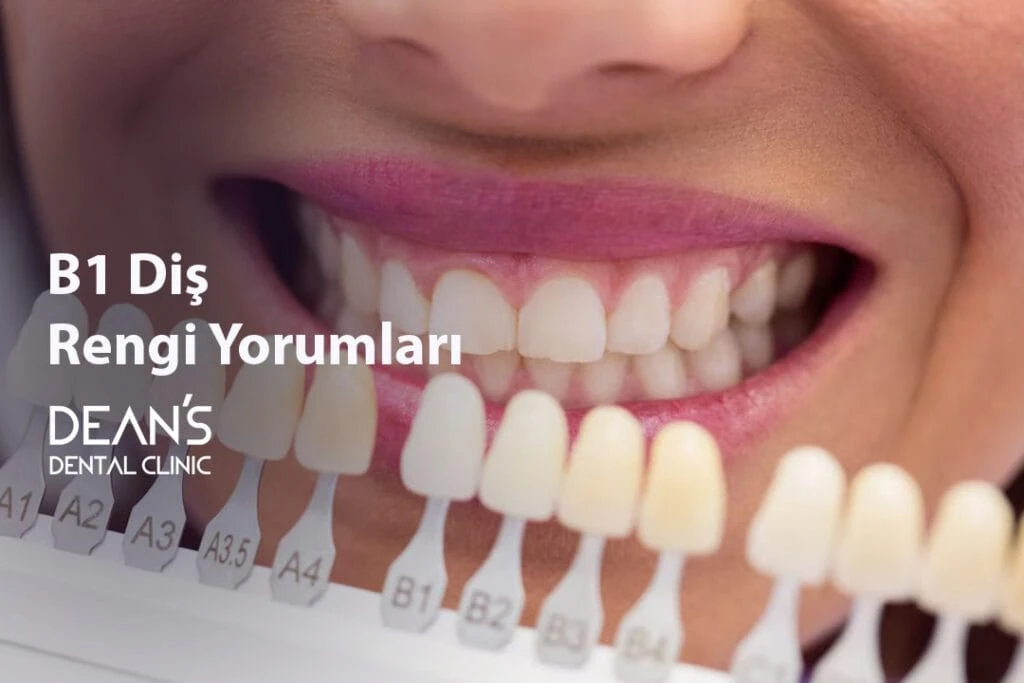 B1 Diş Rengi Yorumları