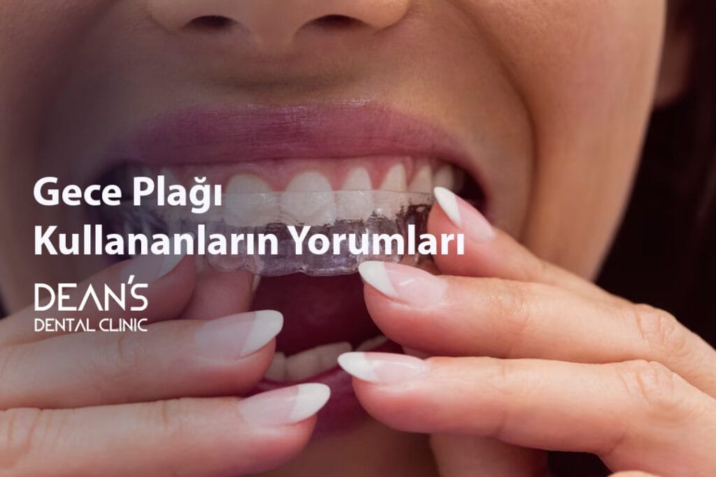 Gece Plağı Kullananların Yorumları