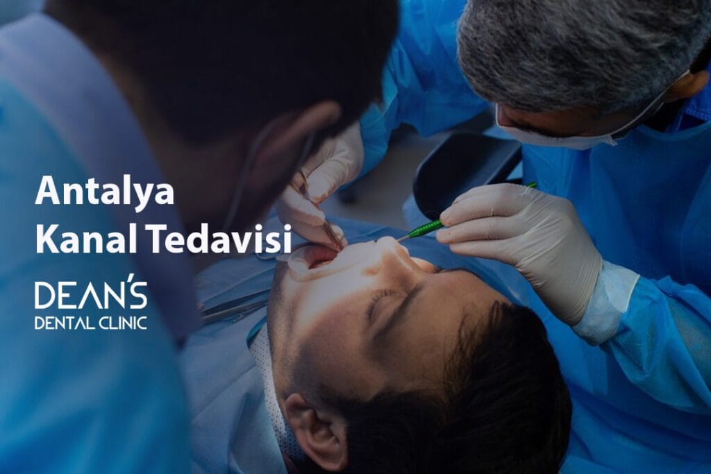 Antalya Kanal Tedavisi
