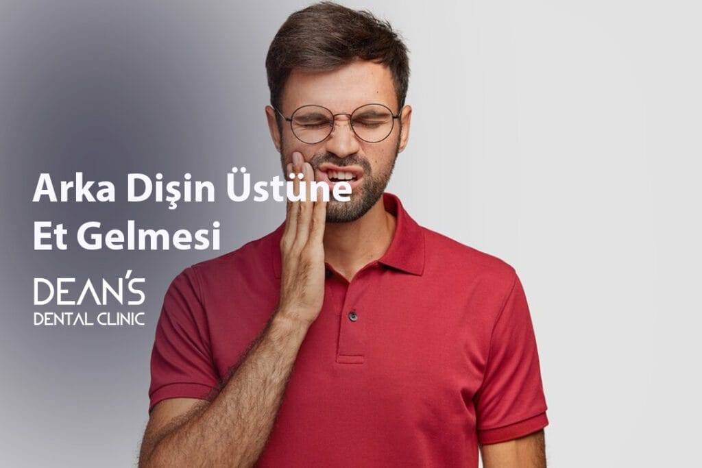 Arka Dişin Üstüne Et Gelmesi Diş Eti Büyümesi