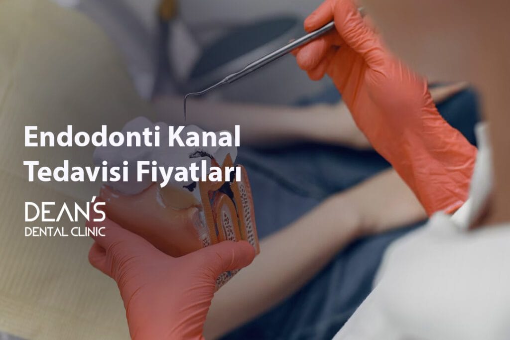 Endodonti Kanal Tedavisi Fiyatları