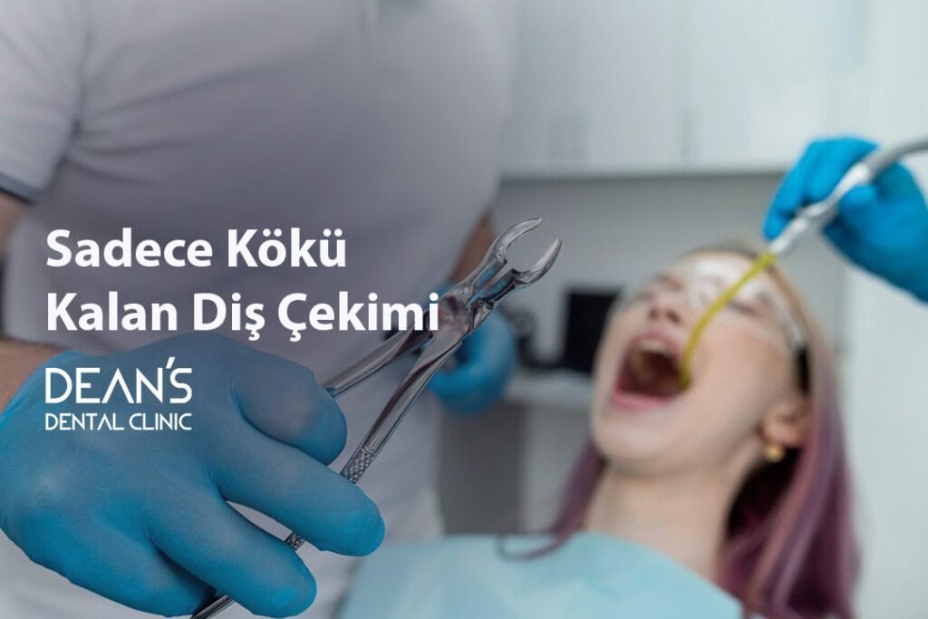 Sadece Kökü Kalan Diş Çekimi