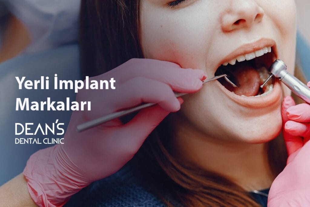 Yerli İmplant Markaları