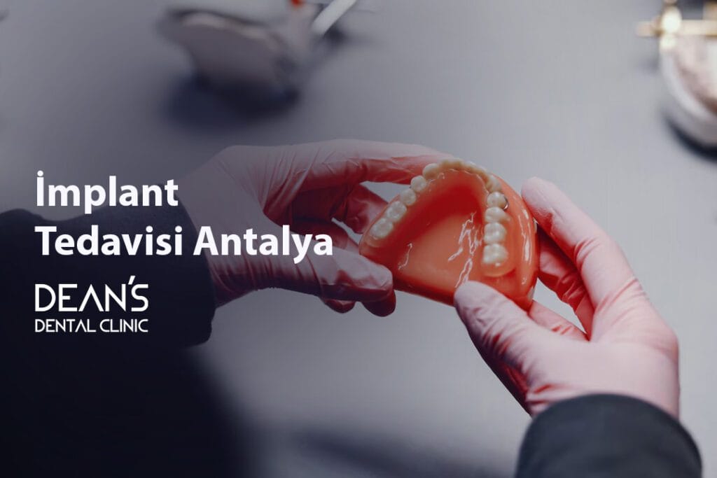 i̇mplant tedavi̇si̇ antalya