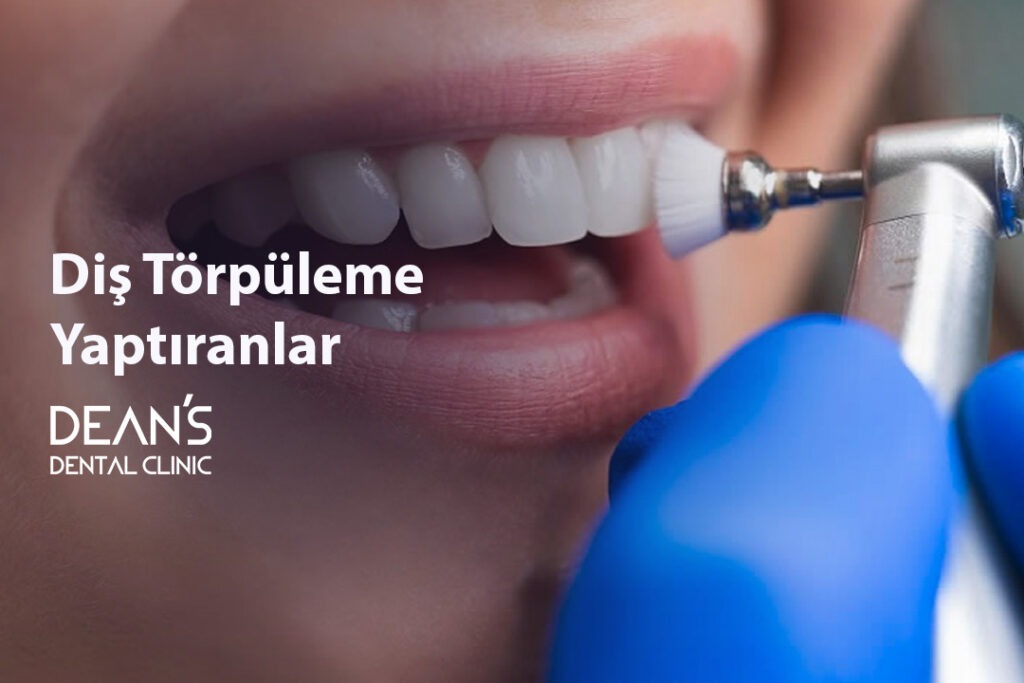 Diş Törpüleme Yaptıranlar