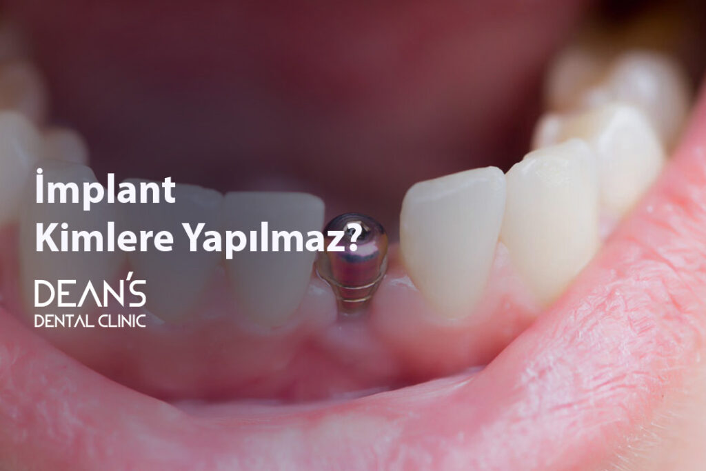 İmplant Kimlere Yapılmaz