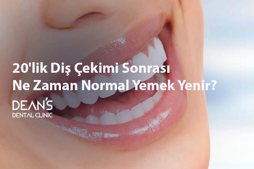 Kemik Rengi Sarı Olan Diş Nasıl Beyazlar