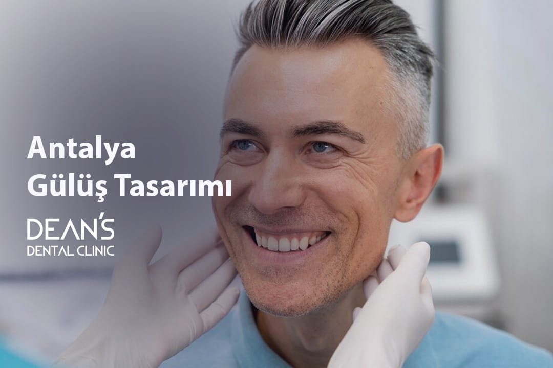 Antalya Gülüş Tasarımı