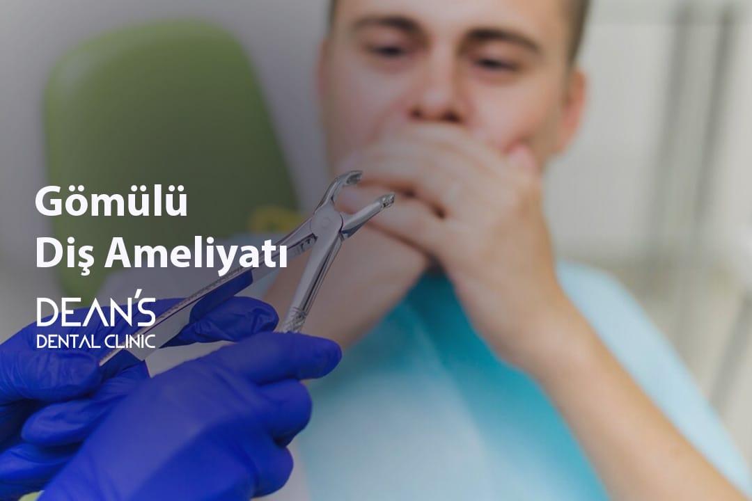 Gömülü Diş Ameliyatı