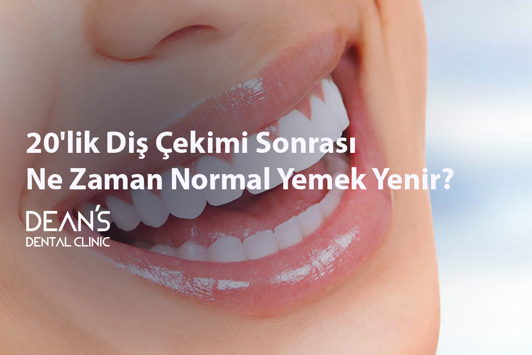Kemik Rengi Sarı Olan Diş Nasıl Beyazlar?