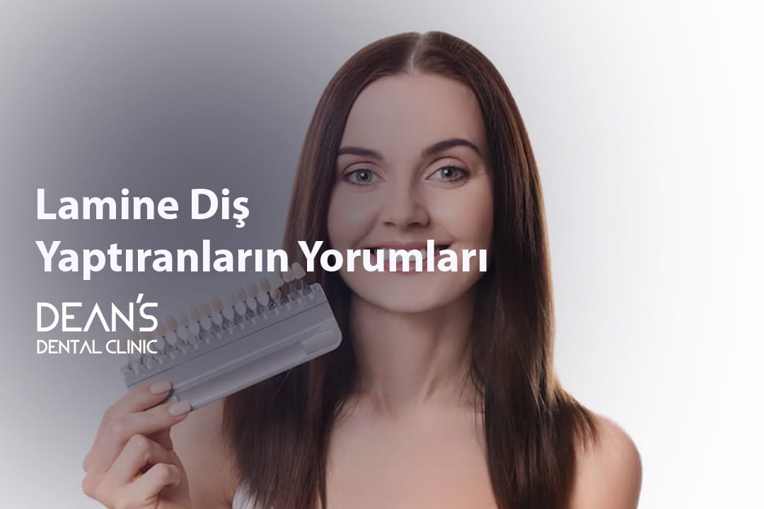 Lamine Diş Yaptıranların Yorumları