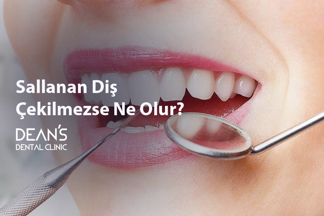 Sallanan Diş Çekilmezse Ne Olur?