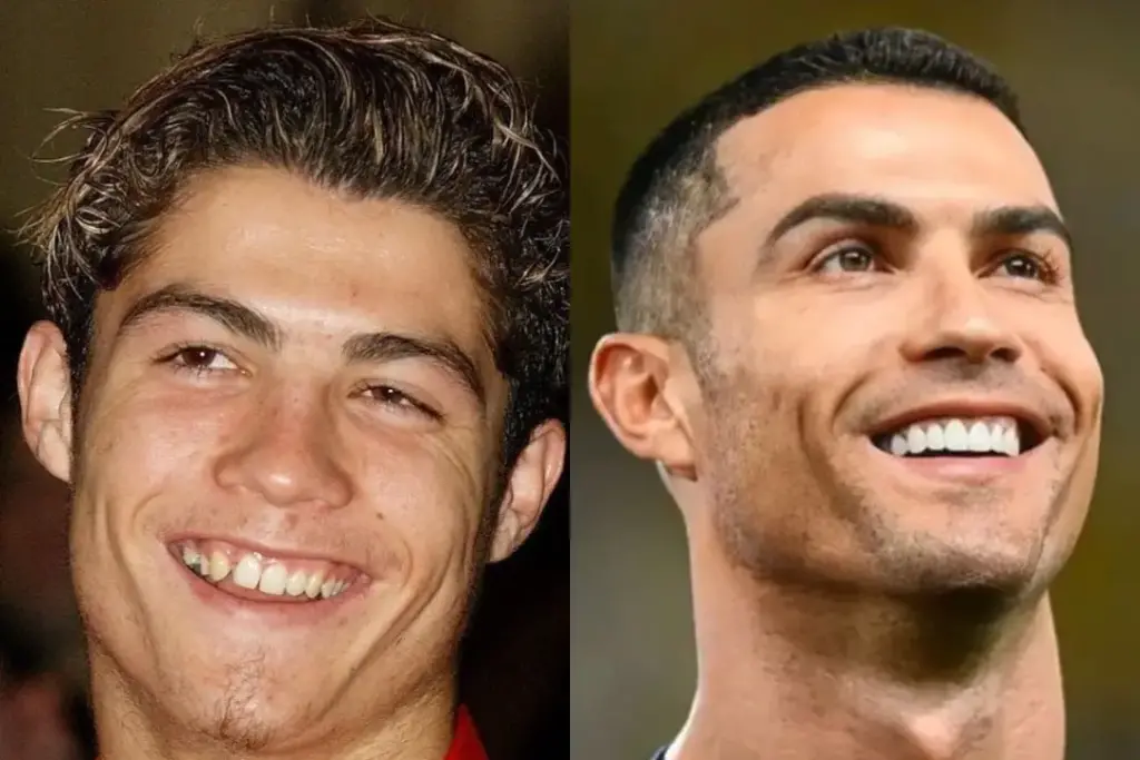 Cristiano Ronaldo Before and After