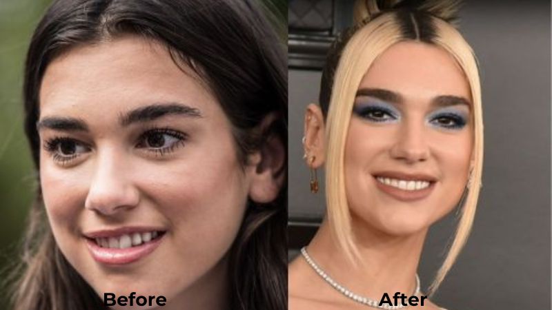 Dua Lipa Before and After