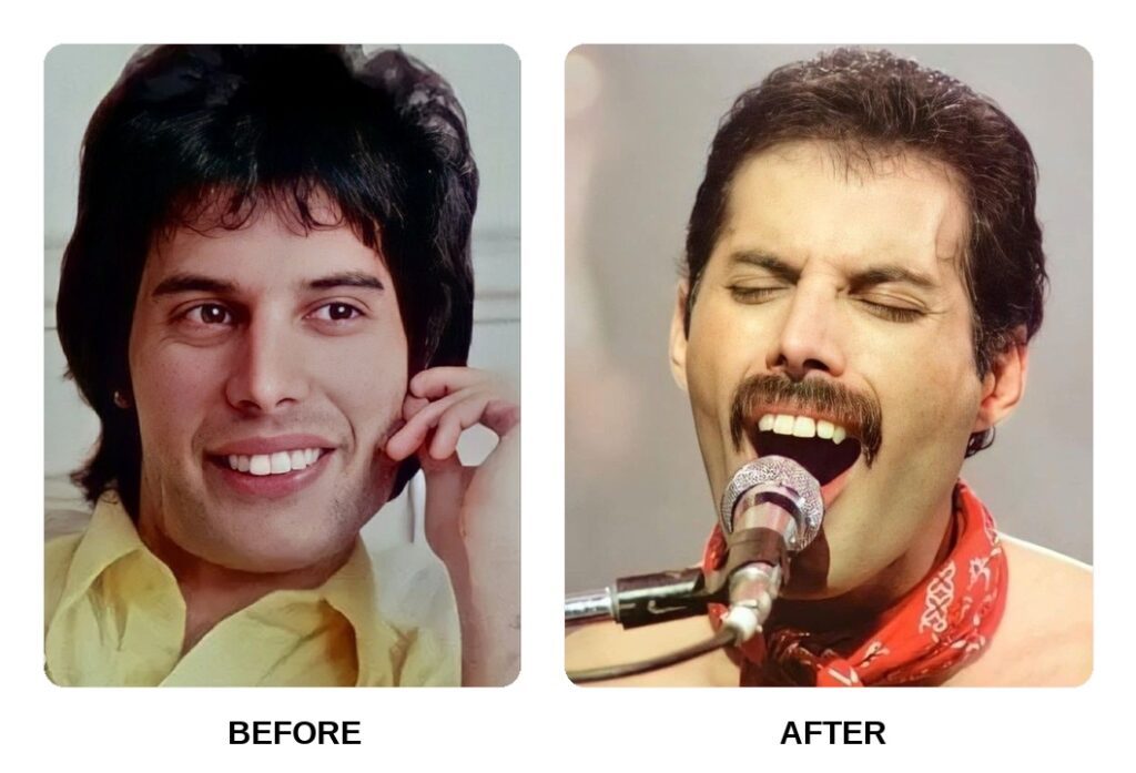 Freddie Mercury Teeth