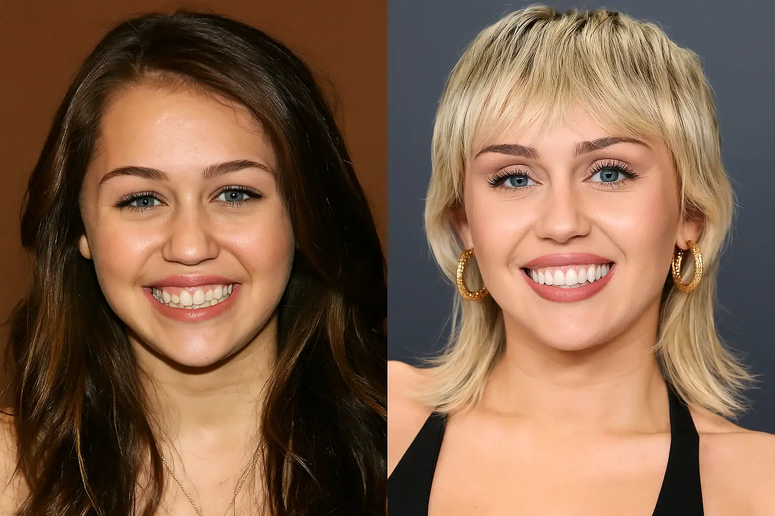 Facettes dentaires de Miley Cyrus