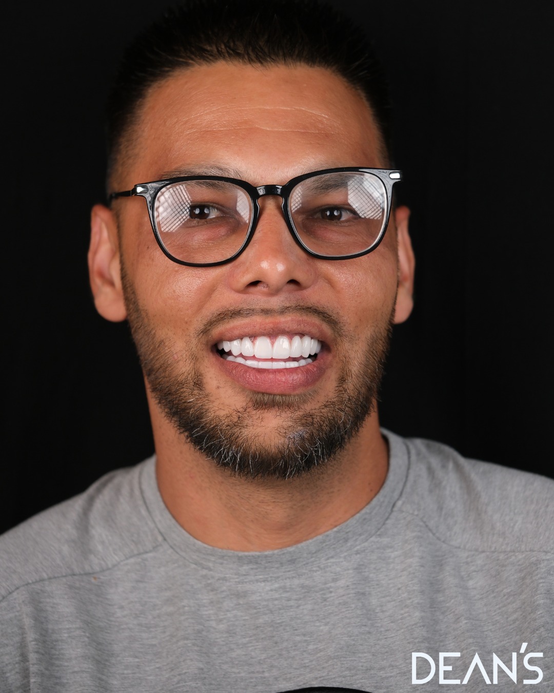 A healthy and beautiful smile is one of the most important factors that refreshes your self-conf