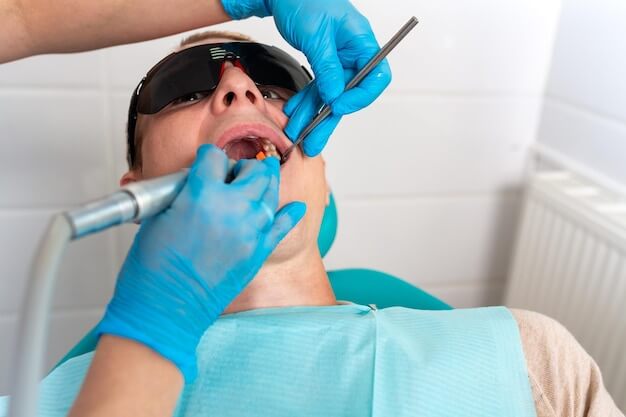 composite filling treatment