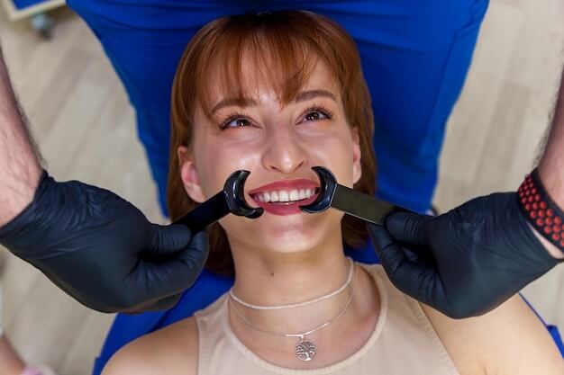 emax & empress veneer treatment
