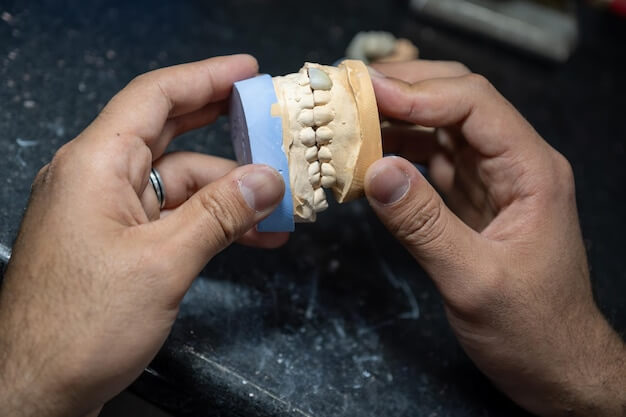 implant-supported prosthesis