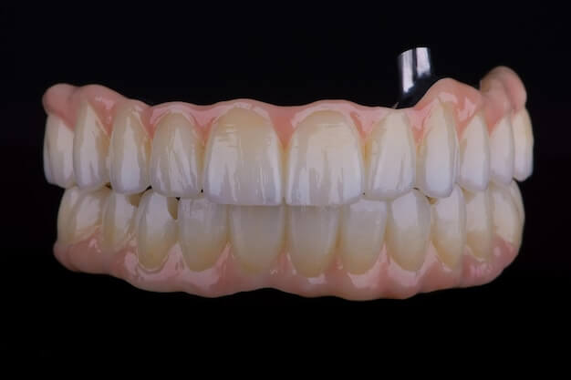 pełna implantacja jamy ustnej