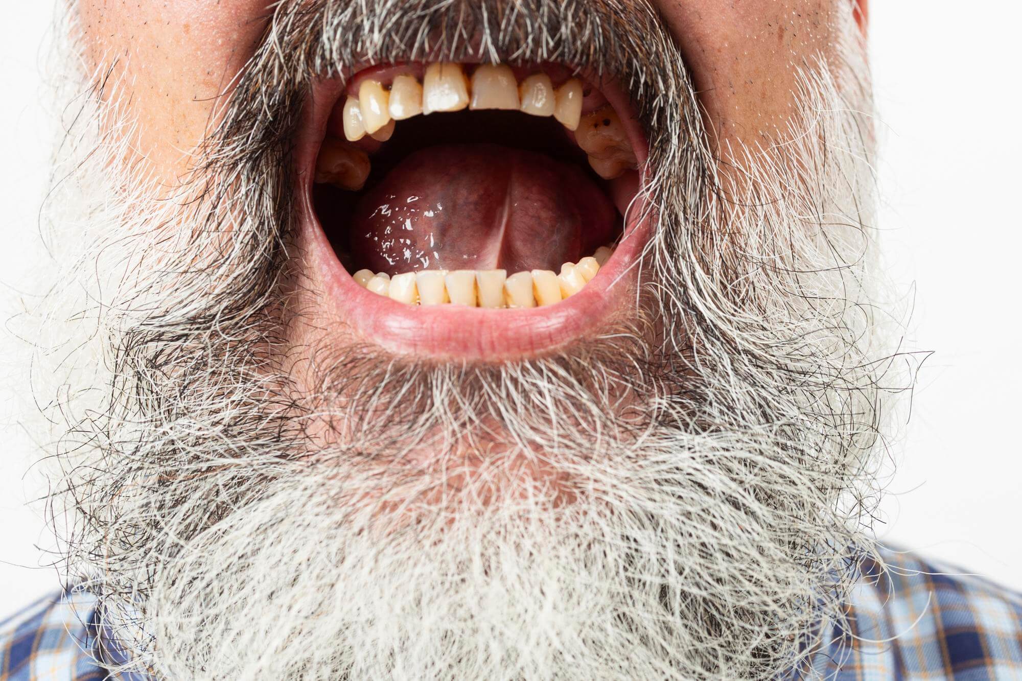 Paul Rudd Teeth