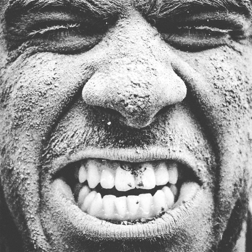 wayne rooney teeth