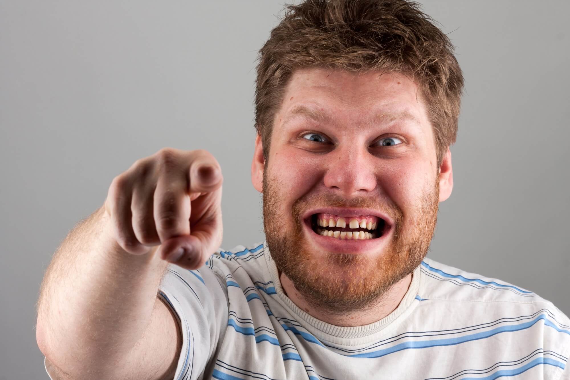 did john krasinski get his teeth fixed?