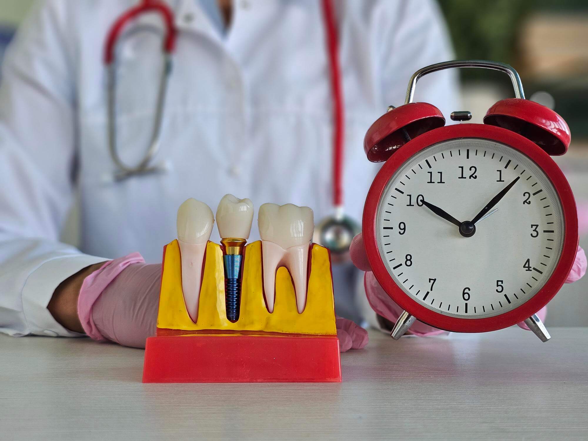can dental implants be done in one day