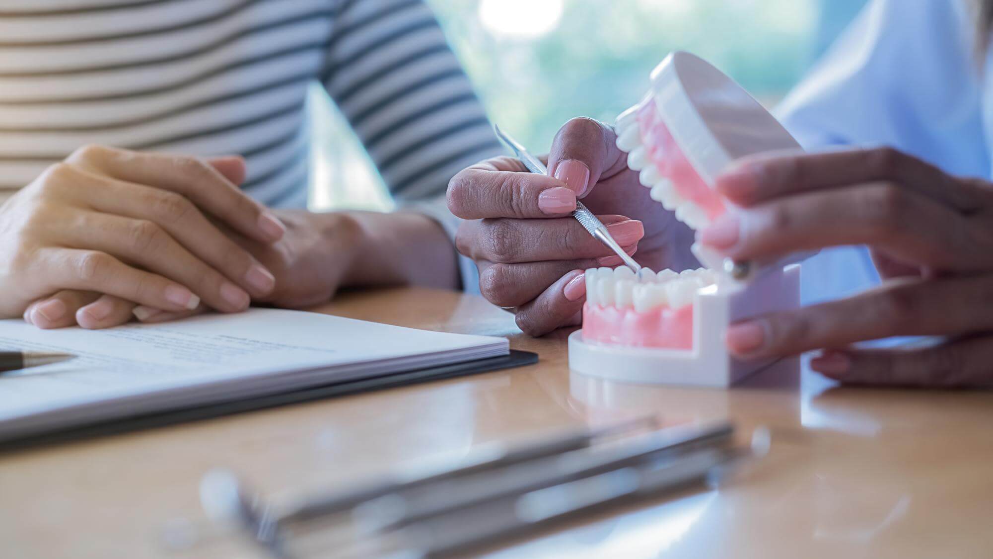 does dental insurance cover dental implants