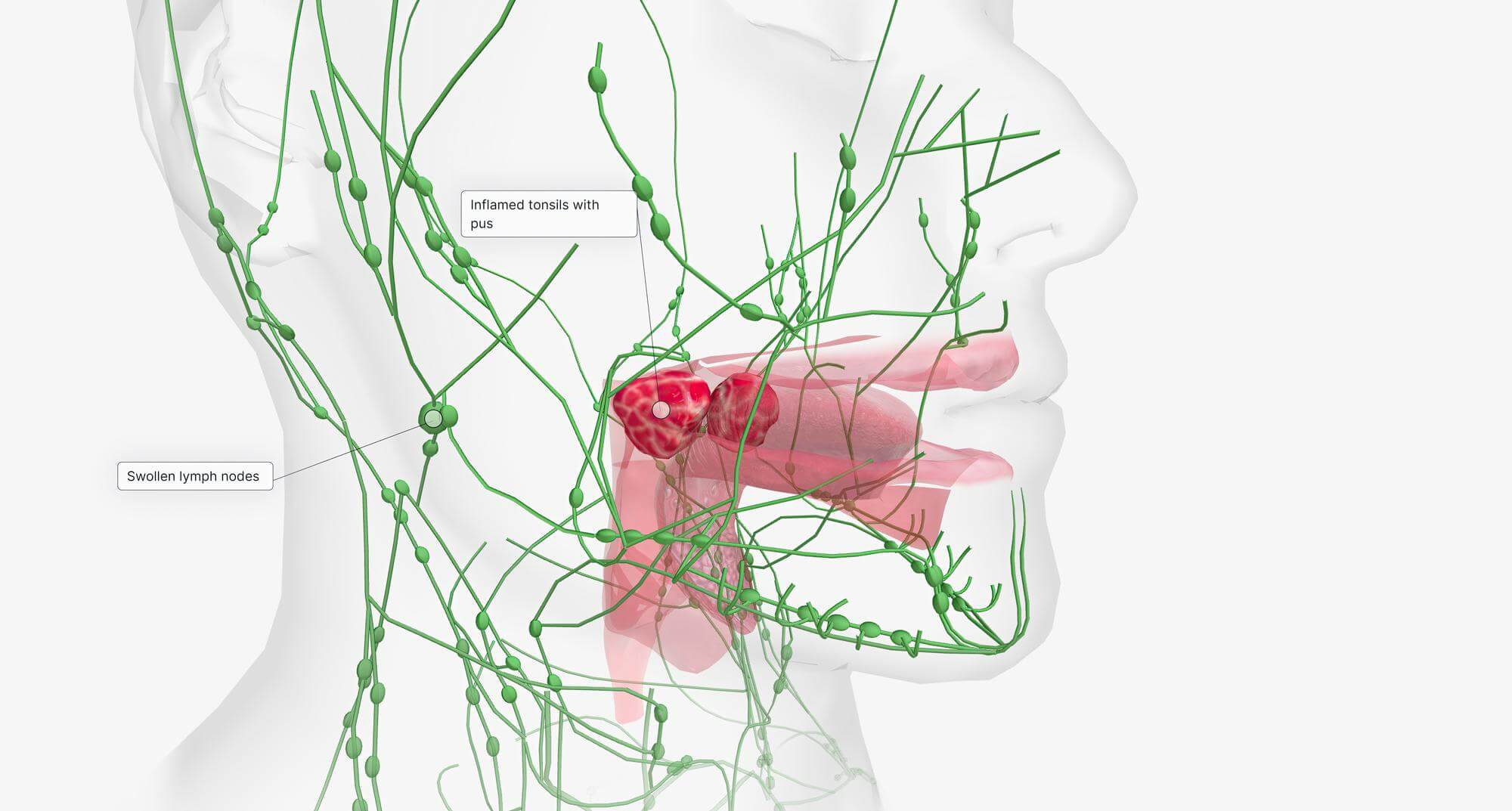 lymph node hurts